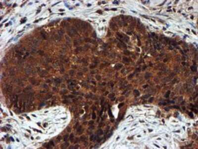 Immunohistochemistry-Paraffin: Proteasome 20S alpha 6 Antibody (OTI4C9) [NBP2-03836]