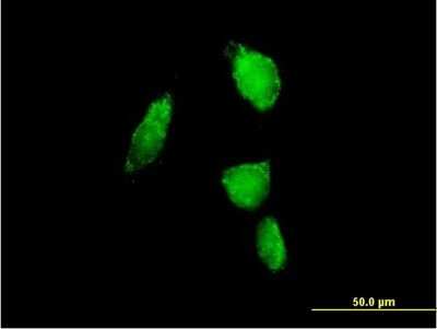 Immunocytochemistry/ Immunofluorescence: Proteasome 20S alpha 6 Antibody [H00005687-B01P]