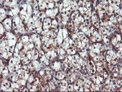 Immunohistochemistry: Proteasome 20S alpha 6 Antibody (OTI3B8) - Azide and BSA Free [NBP2-73642]