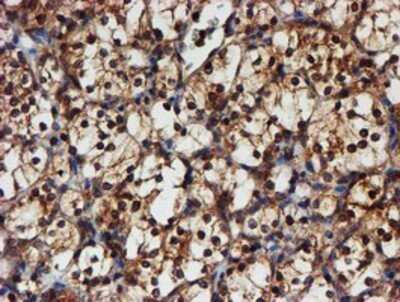Immunohistochemistry: Proteasome 20S alpha 6 Antibody (OTI4C9) - Azide and BSA Free [NBP2-73637]
