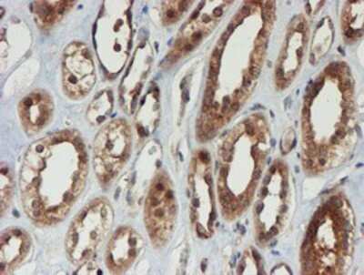 Immunohistochemistry: Proteasome 20S alpha 6 Antibody (OTI4C9) - Azide and BSA Free [NBP2-73637]