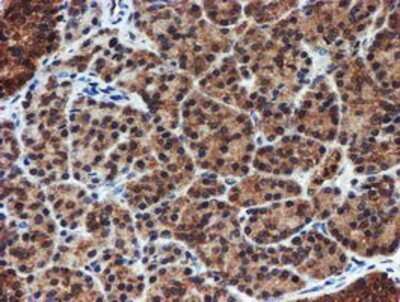 Immunohistochemistry: Proteasome 20S alpha 6 Antibody (OTI4C9) - Azide and BSA Free [NBP2-73637]