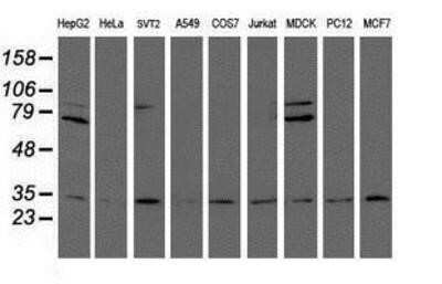 Western Blot: Proteasome 20S alpha 6 Antibody (OTI4C9)Azide and BSA Free [NBP2-73637]