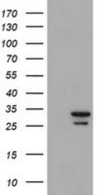 Western Blot: Proteasome 20S alpha 6 Antibody (OTI4C9)Azide and BSA Free [NBP2-73637]