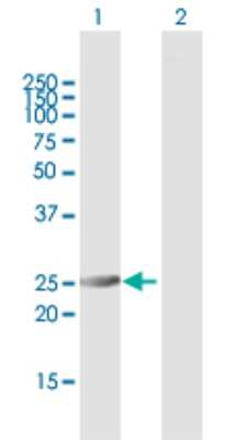 Western Blot: Proteasome 20S alpha 6 Antibody [H00005687-B01P]