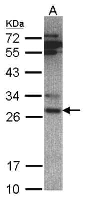 Western Blot: Proteasome 20S alpha 6 Antibody [NBP1-32406]