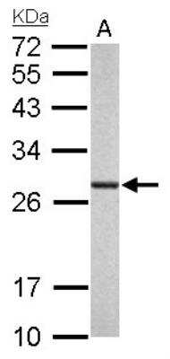 Western Blot: Proteasome 20S alpha 6 Antibody [NBP1-33538]