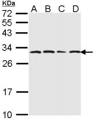 Western Blot: Proteasome 20S alpha 6 Antibody [NBP1-33538]