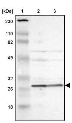 Western Blot: Proteasome 20S alpha 6 Antibody [NBP1-87796]