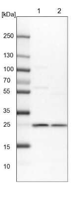 Western Blot: Proteasome 20S alpha 6 Antibody [NBP1-87796]