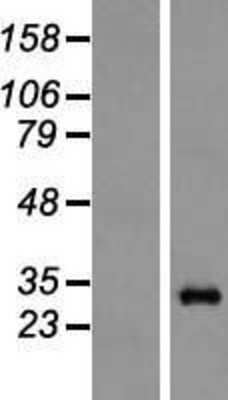 Western Blot: Proteasome 20S alpha 6 Overexpression Lysate [NBL1-14874]