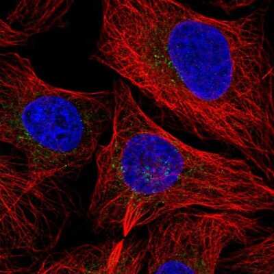 Immunocytochemistry/ Immunofluorescence: Proteasome 20S beta 3 Antibody [NBP2-33516]