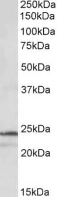 Western Blot: Proteasome 20S beta 3 Antibody [NBP1-52079]