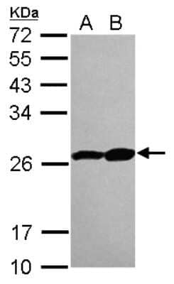 Western Blot: Proteasome 20S beta 3 Antibody [NBP2-19953]