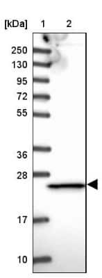 Western Blot: Proteasome 20S beta 3 Antibody [NBP2-33380]