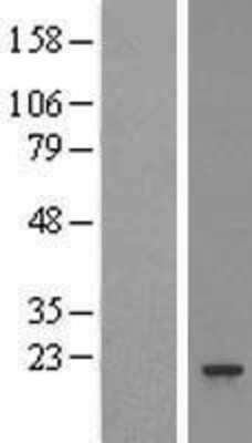 Western Blot: Proteasome 20S beta 3 Overexpression Lysate [NBL1-14878]