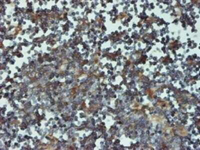 Immunohistochemistry-Paraffin: Proteasome 20S beta 6 Antibody (2A3-5A8) [H00005694-M01]