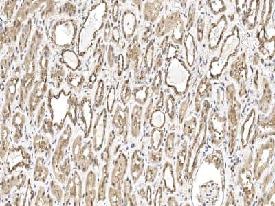 Immunohistochemistry: Proteasome 20S beta 6 Antibody [NBP3-14763]