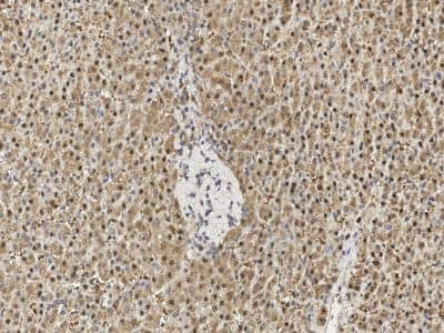 Immunohistochemistry: Proteasome 20S beta 6 Antibody [NBP3-14763]