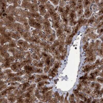 Immunohistochemistry-Paraffin: Proteasome 20S beta 6 Antibody [NBP1-88024]
