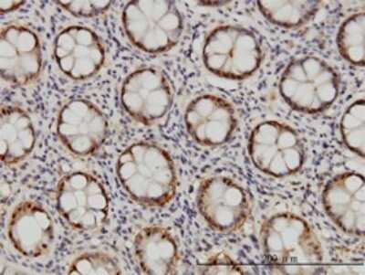 Immunohistochemistry-Paraffin: Proteasome 20S beta 6 Antibody (S51) [H00005694-M02]