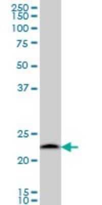 Western Blot: Proteasome 20S beta 6 Antibody (S51) [H00005694-M02]