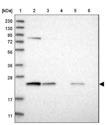 Western Blot: Proteasome 20S beta 6 Antibody [NBP1-88024]