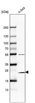 Western Blot: Proteasome 20S beta 6 Antibody [NBP2-57831]