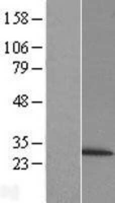 Western Blot: Proteasome 20S beta 6 Overexpression Lysate [NBL1-14881]