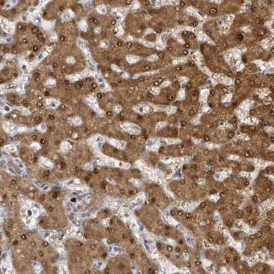 Immunohistochemistry-Paraffin: PSMB7 Antibody [NBP2-13821]