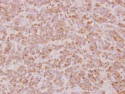 Immunohistochemistry-Paraffin: PSMB7 Antibody [NBP2-19954]