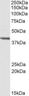 Western Blot: PSMB7 Antibody [NBP1-52081]