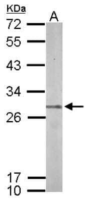 Western Blot: PSMB7 Antibody [NBP2-19954]