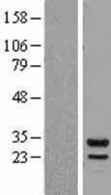 Western Blot: PSMB7 Overexpression Lysate [NBL1-14882]