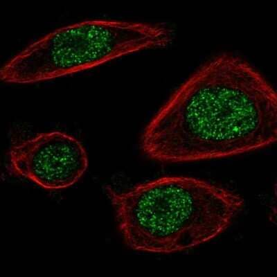 Immunocytochemistry/ Immunofluorescence: Proteasome 20S beta2 Antibody [NBP1-92295]