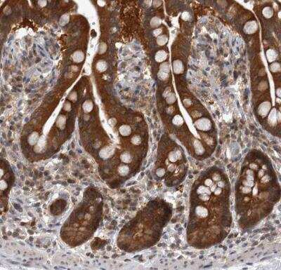 Immunohistochemistry-Paraffin: Proteasome 20S beta2 Antibody [NBP1-92294]