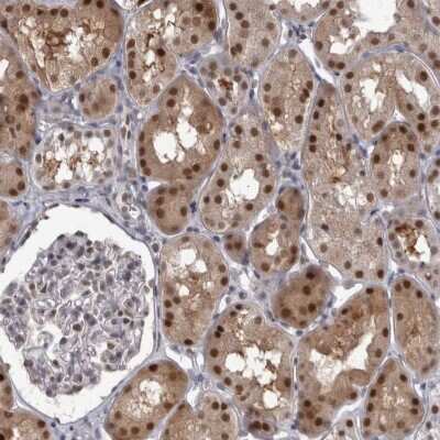 Immunohistochemistry-Paraffin: Proteasome 20S beta2 Antibody [NBP1-92295]