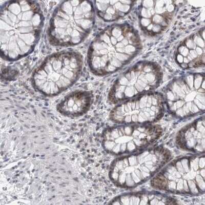 Immunohistochemistry-Paraffin: Proteasome 20S beta2 Antibody [NBP1-92295]
