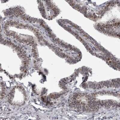 Immunohistochemistry-Paraffin: Proteasome 20S beta2 Antibody [NBP1-92295]