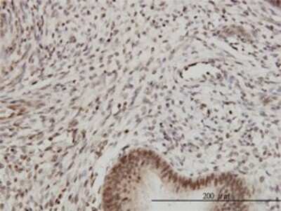 Immunohistochemistry-Paraffin: Proteasome 20S beta2 Antibody (M1) [H00005690-M02]