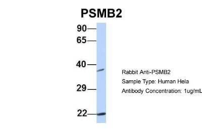 Western Blot: Proteasome 20S beta2 Antibody [NBP1-54589]