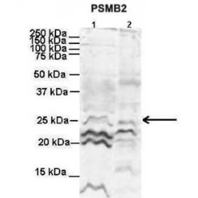 Western Blot: Proteasome 20S beta2 Antibody [NBP1-54590]