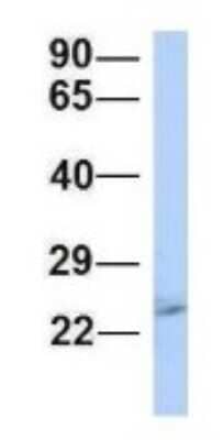 Western Blot: Proteasome 20S beta2 Antibody [NBP1-54590]