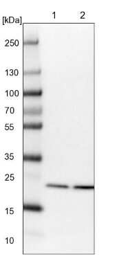 Western Blot: Proteasome 20S beta2 Antibody [NBP1-92294]