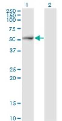 Western Blot: Proteasome 26S S5 Antibody (1H7) [H00005711-M17]