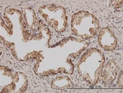 Immunohistochemistry-Paraffin: Proteasome 26S S5 Antibody (3E2) [H00005711-M01]