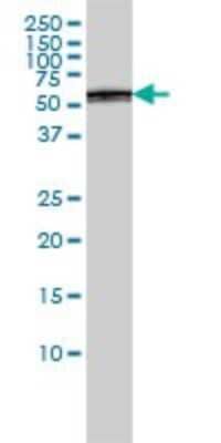 Western Blot: Proteasome 26S S5 Antibody (3E2) [H00005711-M01]