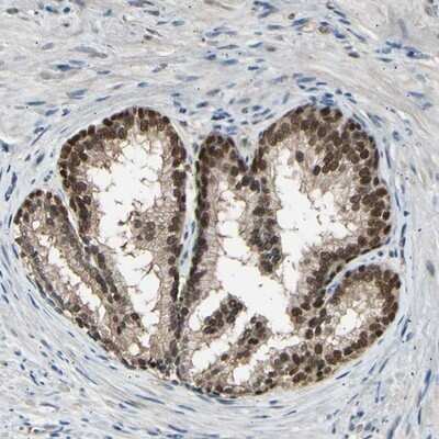 Immunohistochemistry-Paraffin: Proteasome 26S S5 Antibody [NBP1-87800]