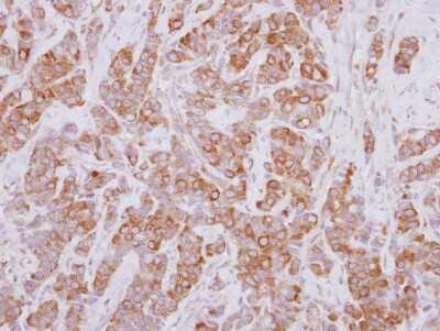 Immunohistochemistry-Paraffin: Proteasome 26S S5 Antibody [NBP2-19956]