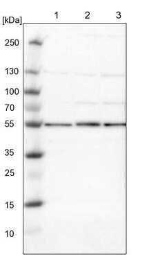 Western Blot: Proteasome 26S S5 Antibody [NBP1-87800]